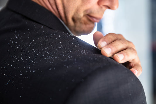 How to Get Rid of Dandruff for Men [and Other Tips]
